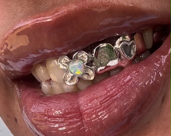 Custom grillz